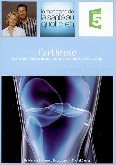 arthrose (L') - 