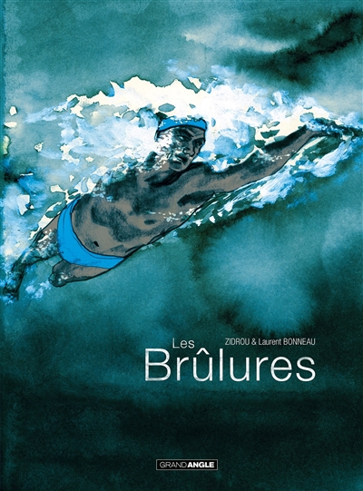 Les brûlures - 